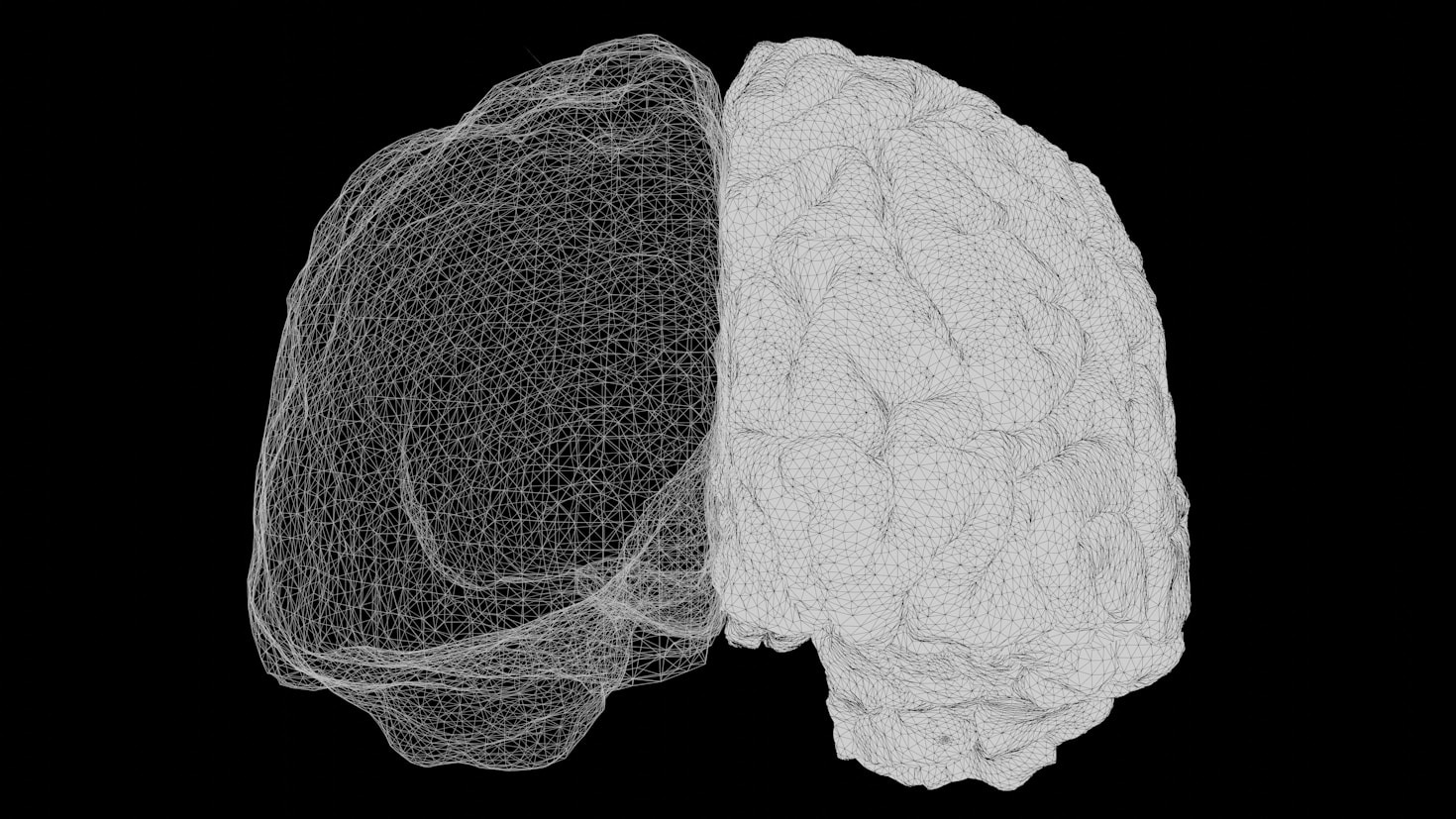 Cómo el neurofeedback ayuda en el TDAH